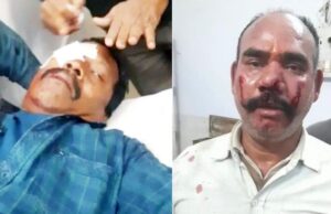 एसईसीएल में कबाड़ चोरों ने सुरक्षा कर्मी की फोड़ी आंख, बलगी सेन्ट्रल वर्कशॉप में वारदात