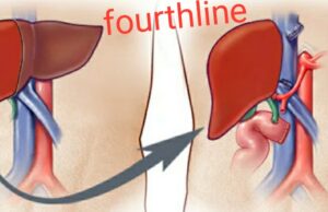 Health care: कैंसर या अन्य गंभीर मर्ज का अब छत्तीसगढ़ में ही आसान और सफल इलाज संभव