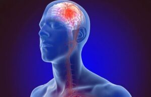 बदलते मौसम से स्ट्रोक का खतरा,गुनगुने पानी से नहाएं, सीधे ठंड में ना निकलें