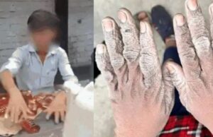 Child labour in liquor factory: शराब की फैक्ट्री में 59 बच्चे मिले काम करते, सरकार ने डिस्टिलरी को किया सील, बच्चों के गल गए थे हाथ