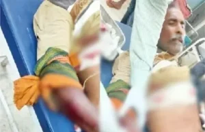 Shot fired in Balrampur: नकाबपोश हमलावरों ने कांग्रेस नेता के भाई को मारी गोली, हालत गंभीर