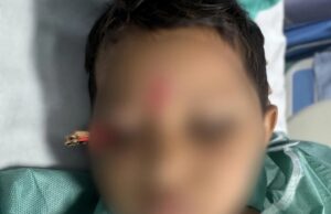 Be careful: खेलते हुए तीन साल की बच्ची की आंख में 10 सेमी तक घुसी पेंसिल, एम्स में हुआ सफल ऑपरेशन